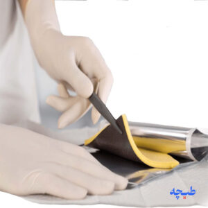 پانسمان فوم آسکینا کالگیترول نقره بی بران