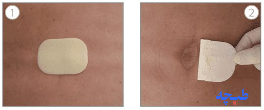 Askina® Transorbent