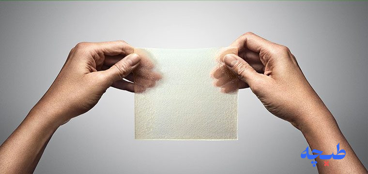 پانسمان هیدروفایبر نقره اگزوفایبر مونلیکه 6