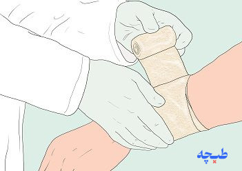 روش استفاده از گاز وازلینه کیتوتک