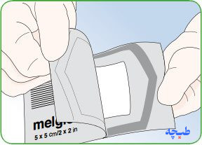 پانسمان آلژینات جاذب نقرهدار ملجیزورب آژ 2