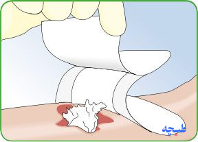 پانسمان آلژینات جاذب نقرهدار ملجیزورب آژ 4