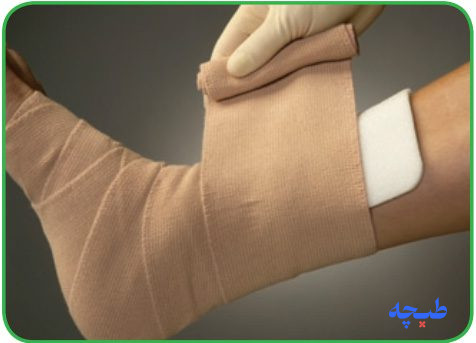 ثابت کردن پانسمان مپیلکس با فیکس کننده
